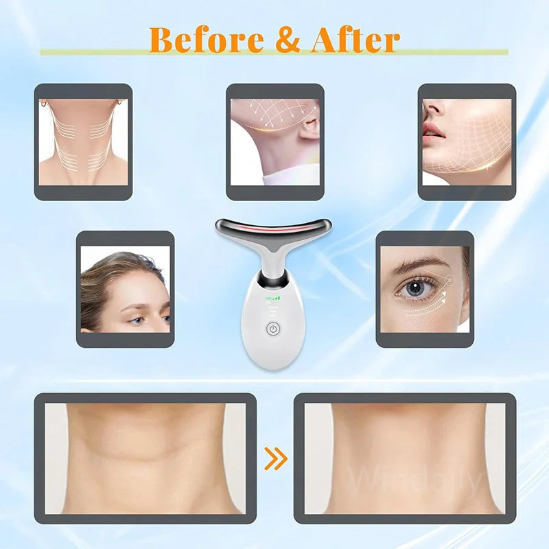VIONA 7-in-1 LED Facial Sculptor